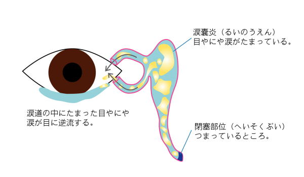 生後 2 ヶ月 目やに